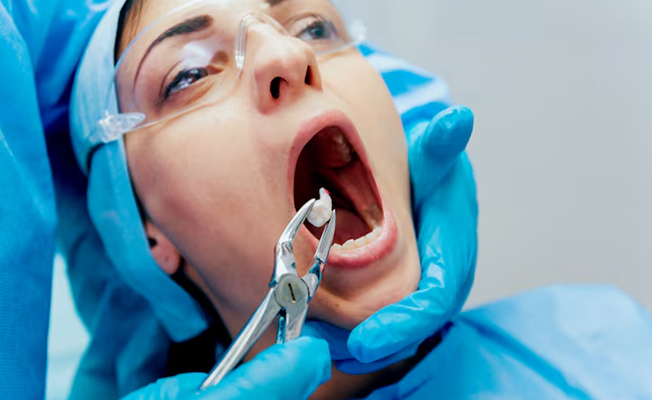 Denture fabrication