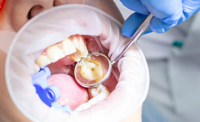 Dental consultation