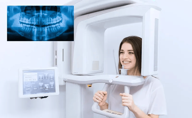 Denture fabrication
