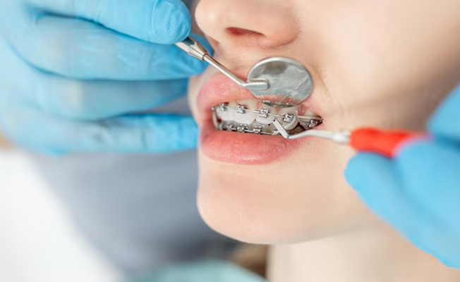 Denture fabrication