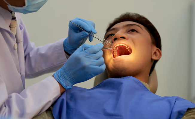 Denture fitting